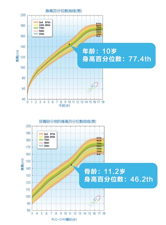 如何正確理解，科學評價孩子的身高？_06.jpg