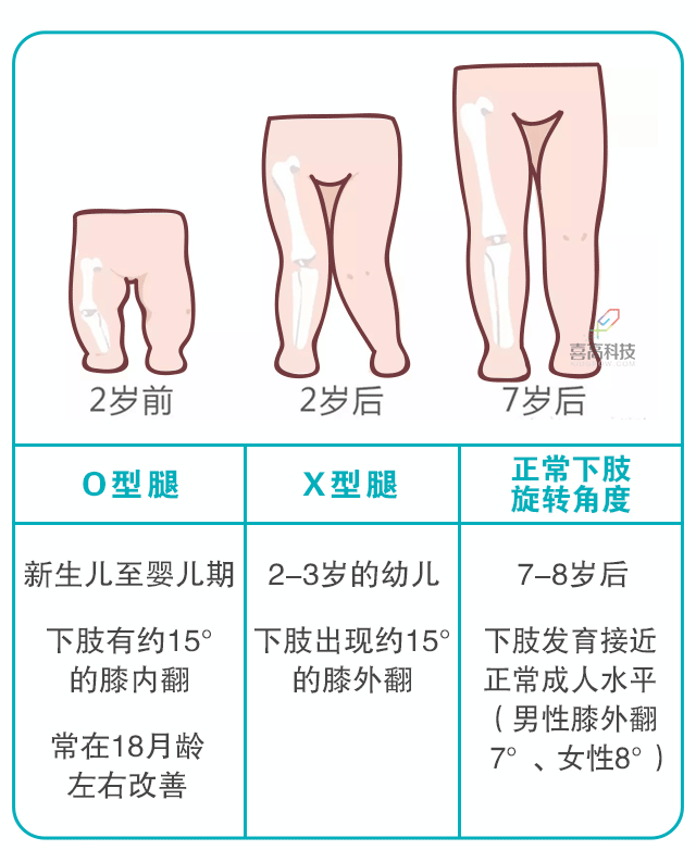 寶寶身長(zhǎng)腿短，長(zhǎng)大會(huì)是矮個(gè)子嗎？_03.gif